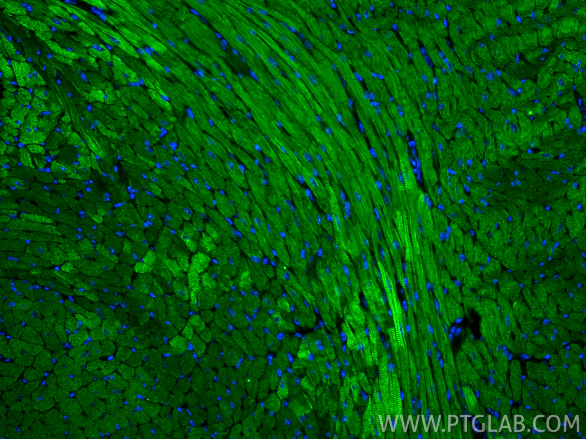 IF Staining of mouse heart using CL488-68300 Immunofluorescence (IF) / fluorescent staining of mouse heart tissue using CoraLite® Plus 488-conjugated Cardiac Troponin T M (CL488-68300)