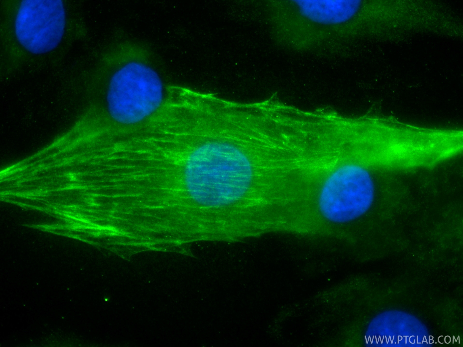 IF Staining of H9C2 using CL488-68300 Immunofluorescence (IF) / fluorescent staining of H9C2 cells using CoraLite® Plus 488-conjugated Cardiac Troponin T M (CL488-68300)