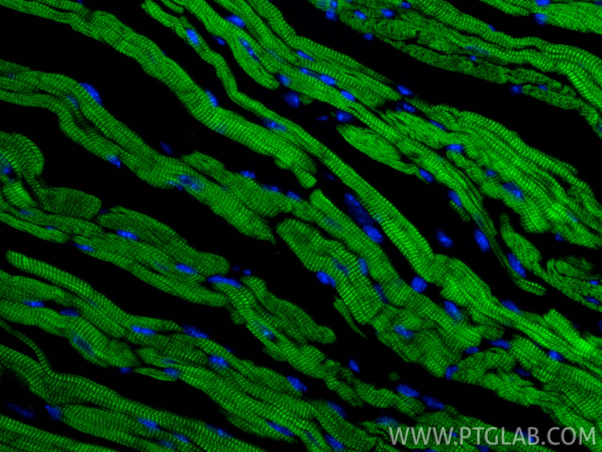 Immunofluorescence (IF) / fluorescent staining of mouse heart tissue using CoraLite® Plus 488-conjugated Cardiac Troponin T R (CL488-81638-3)