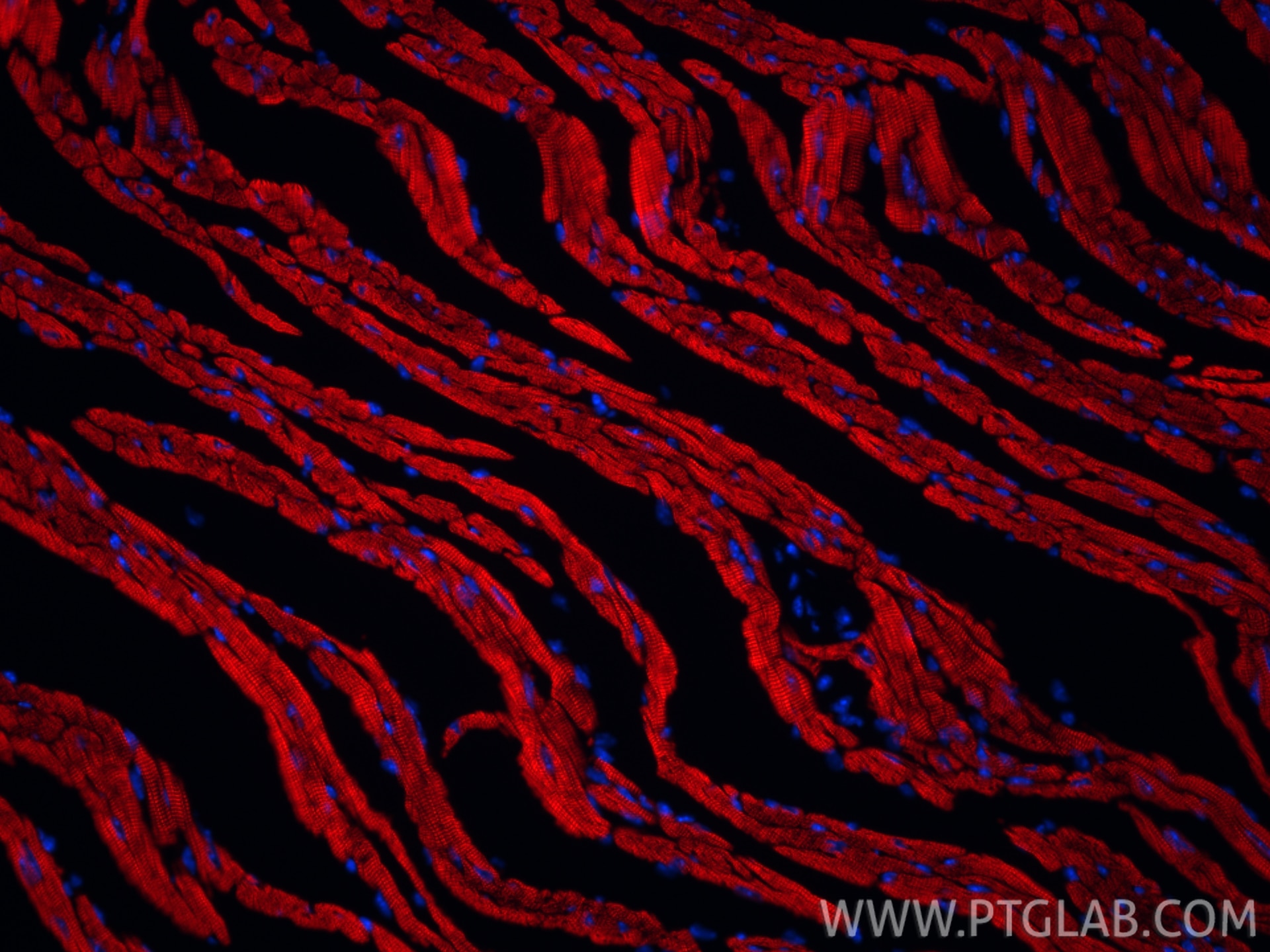 Immunofluorescence (IF) / fluorescent staining of mouse heart tissue using CoraLite®594-conjugated Cardiac Troponin T Recombi (CL594-81638-3)