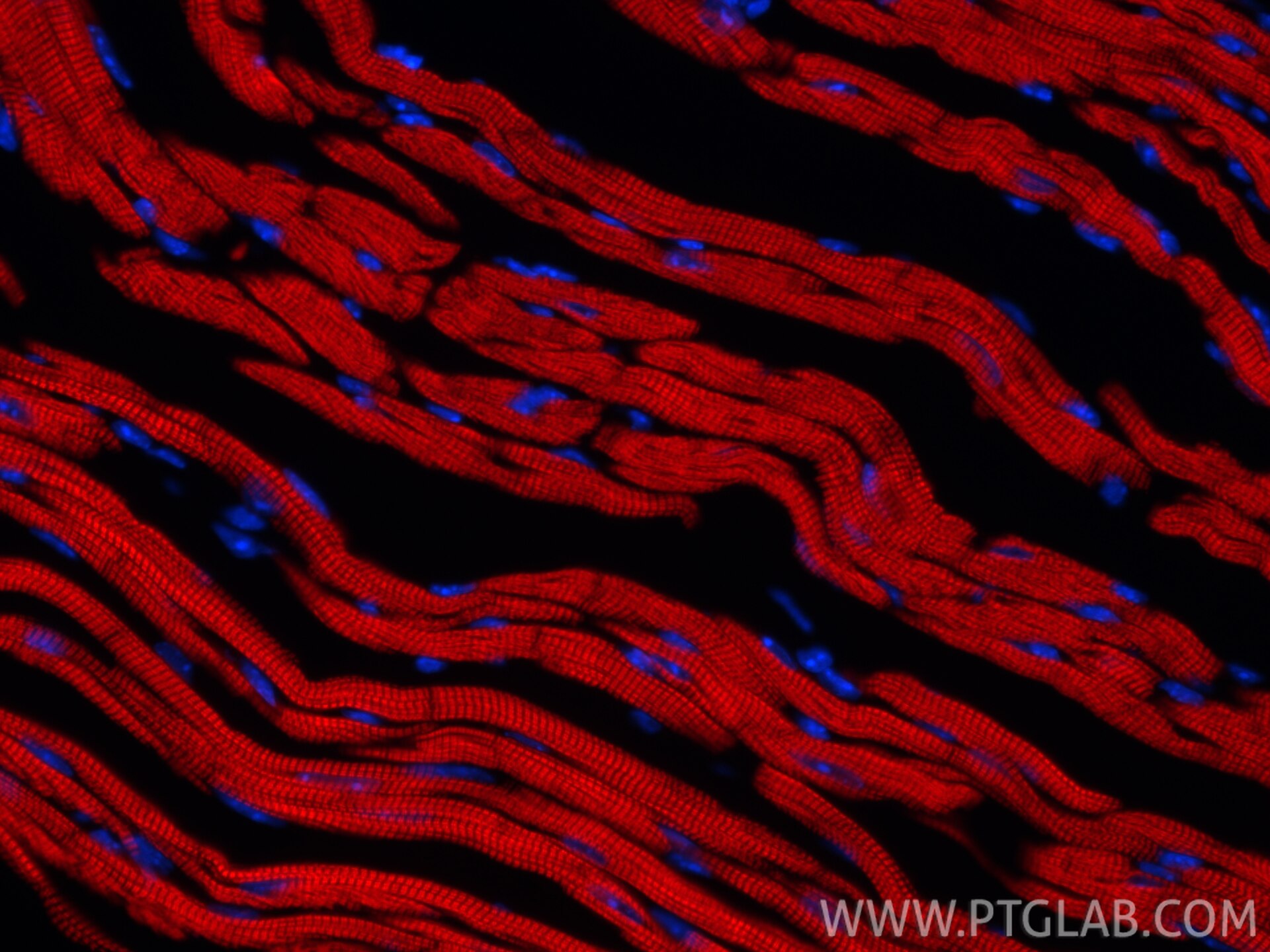 Immunofluorescence (IF) / fluorescent staining of mouse heart tissue using CoraLite®594-conjugated Cardiac Troponin T Recombi (CL594-81638-3)