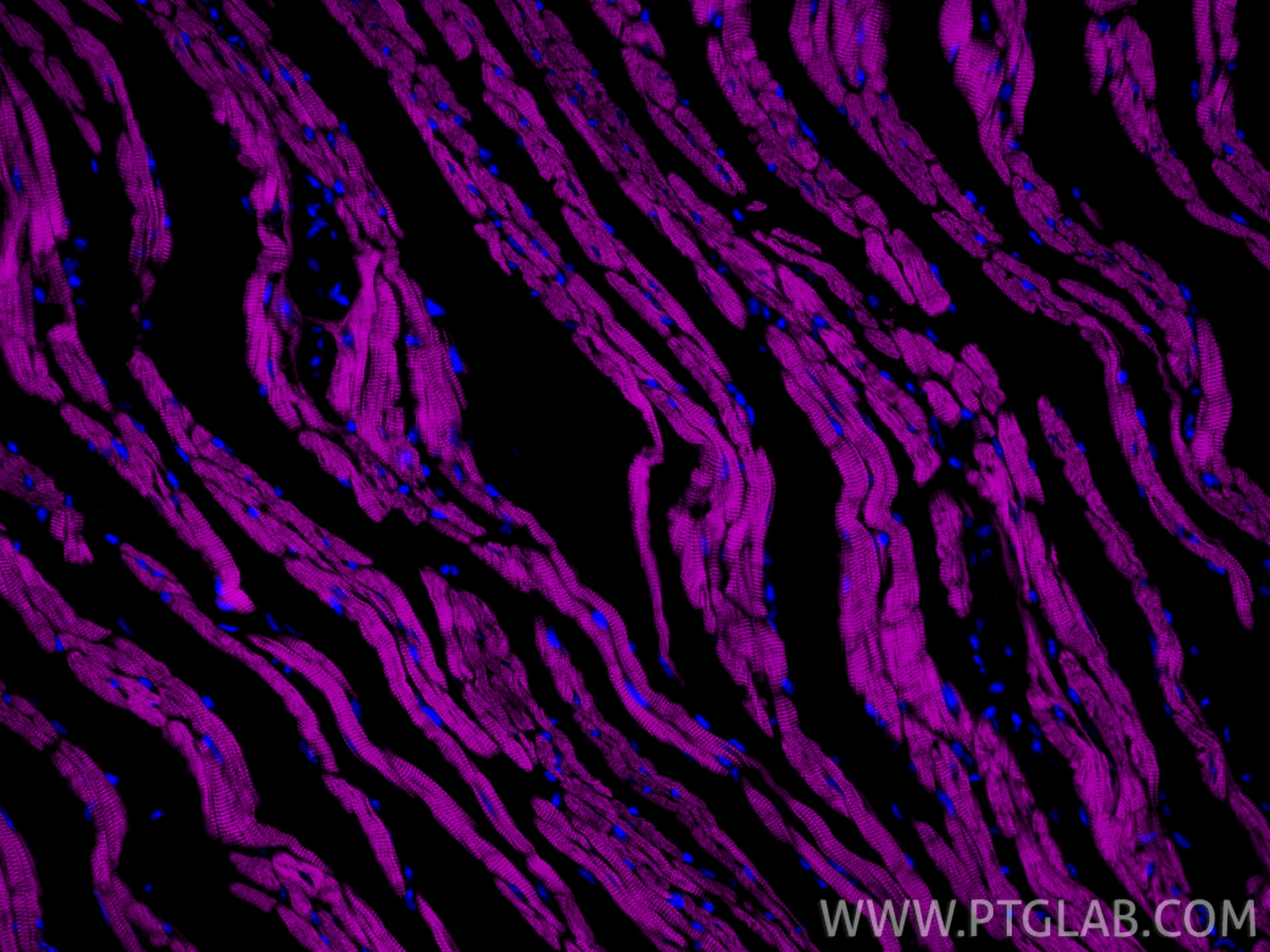 Immunofluorescence (IF) / fluorescent staining of mouse heart tissue using CoraLite® Plus 647-conjugated Cardiac Troponin T R (CL647-81638-3)