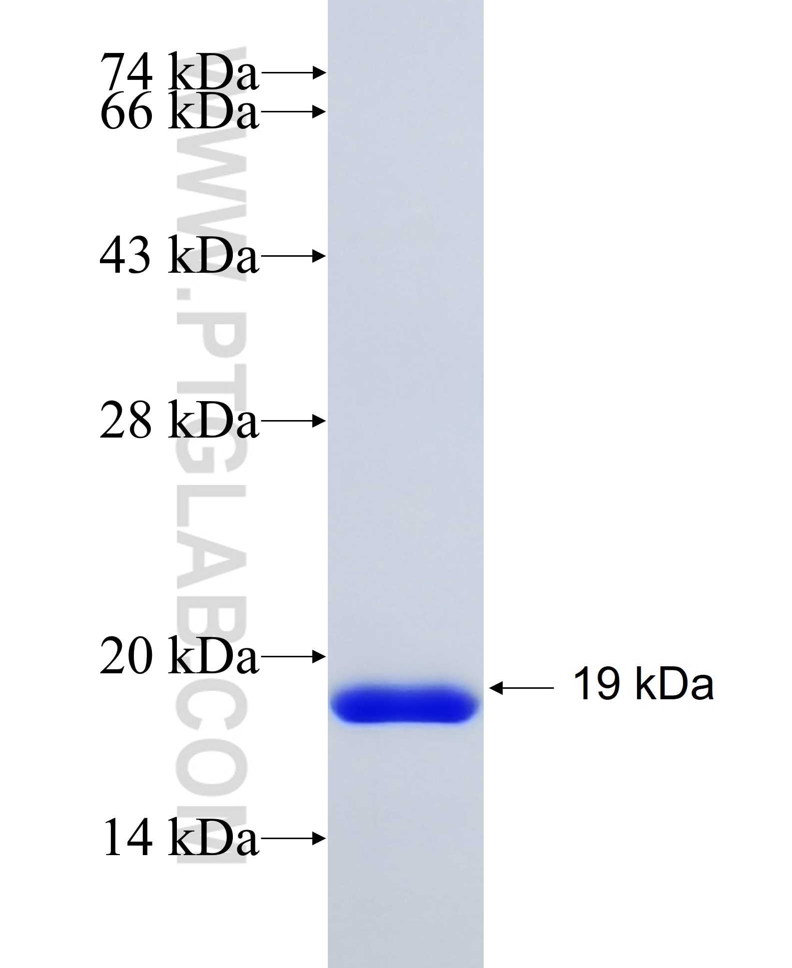 Cas9 fusion protein Ag25281 SDS-PAGE