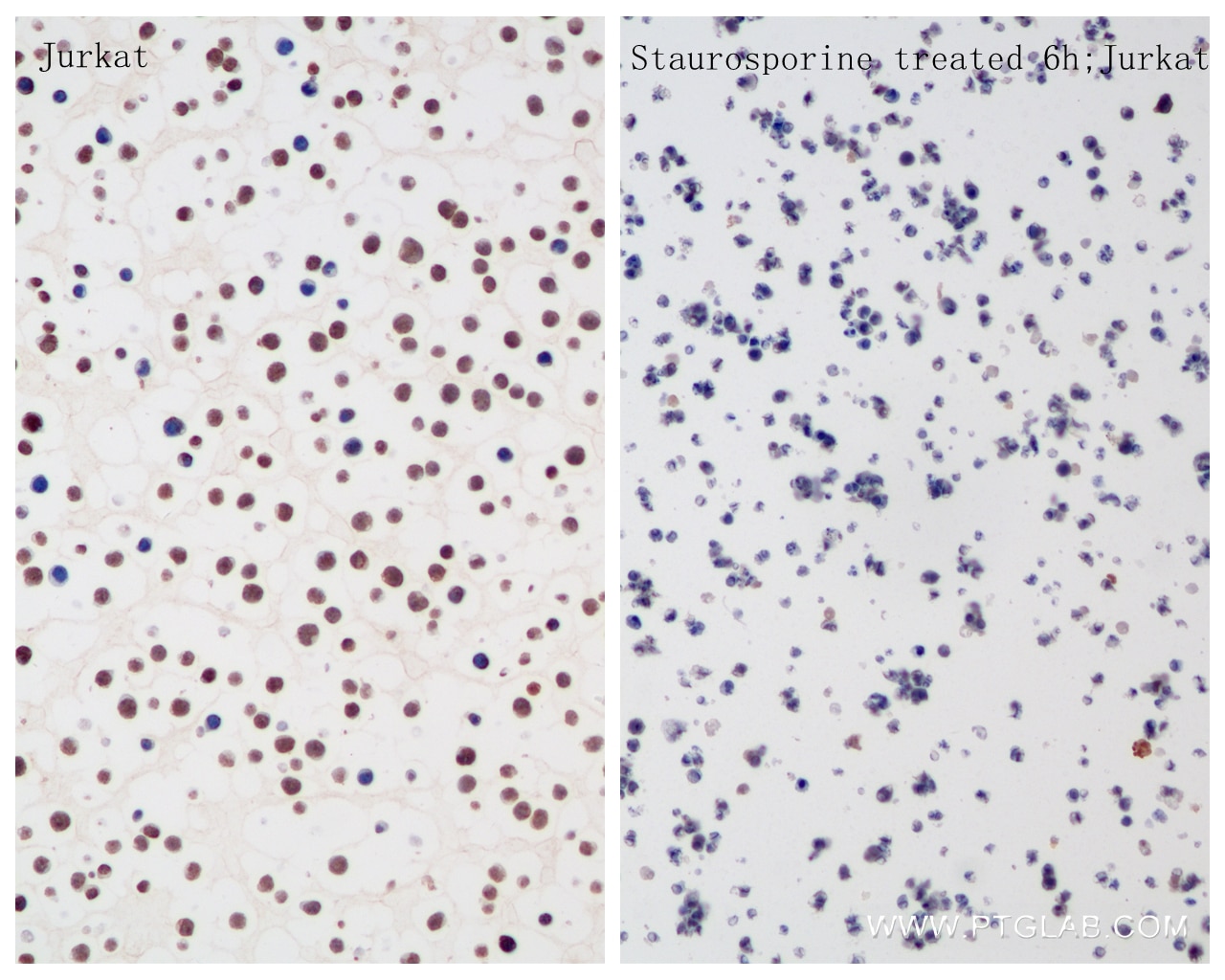 Immunohistochemistry (IHC) staining of Jurkat cells using Caspase 10 Recombinant antibody (85196-3-RR)