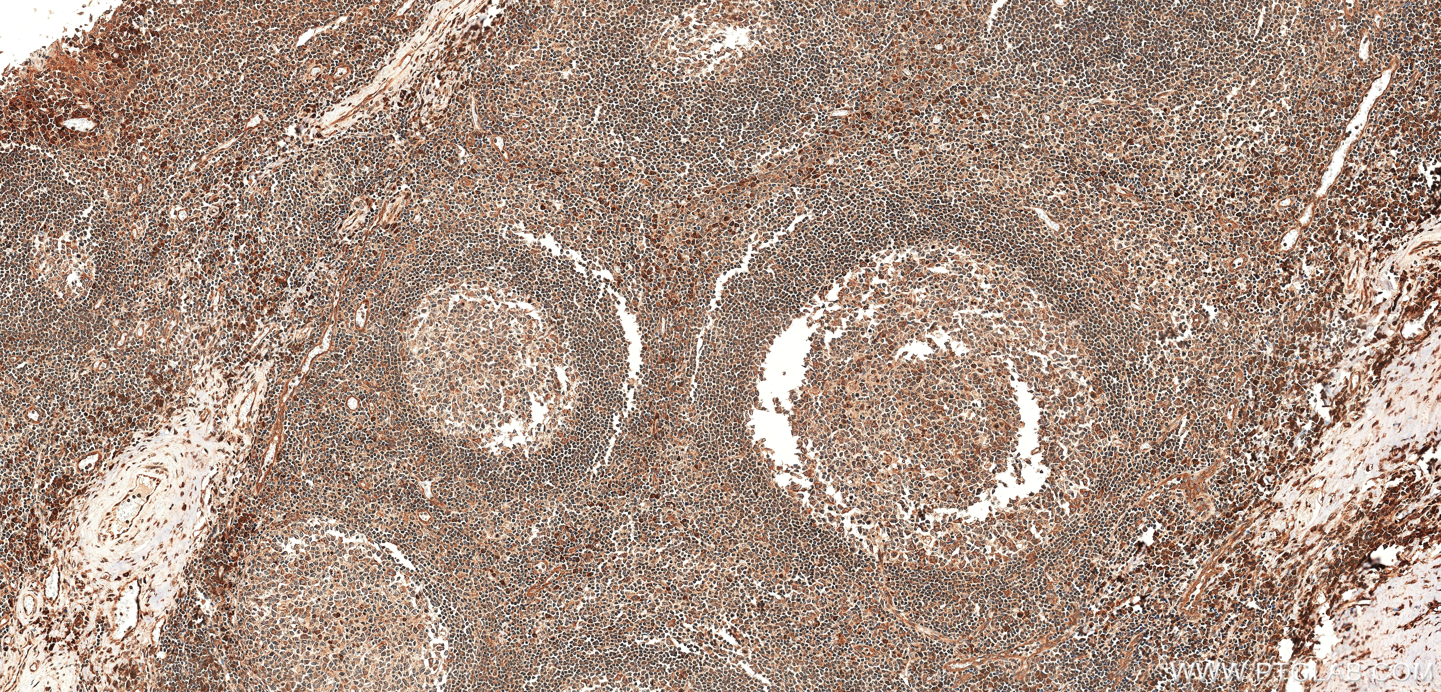 IHC staining of human tonsil using 85196-3-RR Immunohistochemistry (IHC) staining of human tonsil tissue using Caspase 10 Recombinant monoclonal antibody (85196-3-RR)