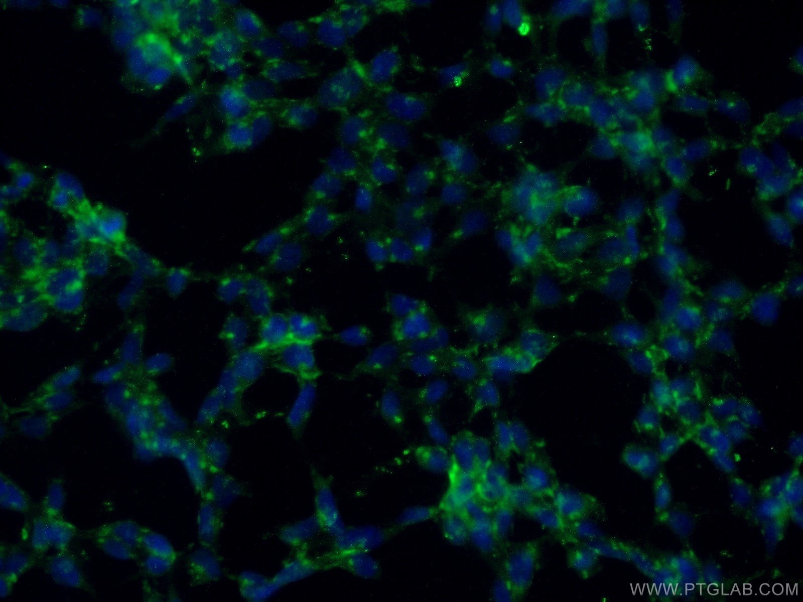 Immunofluorescence (IF) / fluorescent staining of HEK-293 cells using Caspase 2/p18 Polyclonal antibody (24777-1-AP)