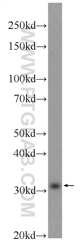 Western Blot (WB) analysis of mouse kidney tissue using Caspase 2/p18 Polyclonal antibody (24777-1-AP)