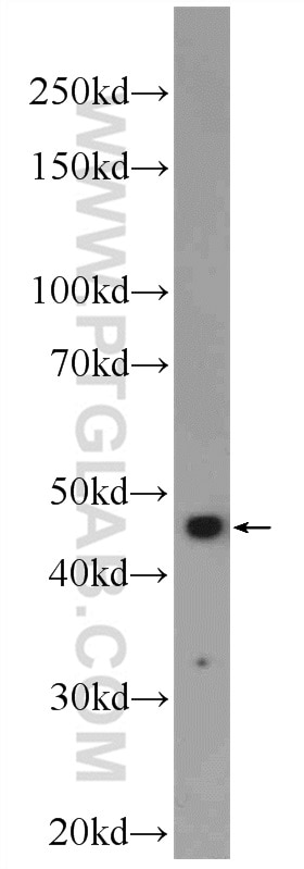 Western Blot (WB) analysis of Jurkat cells using Caspase 2/p18 Polyclonal antibody (24777-1-AP)