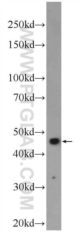 WB analysis of Jurkat using 24777-1-AP