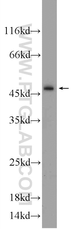 Western Blot (WB) analysis of HEK-293 cells using Caspase 2/p18 Polyclonal antibody (24777-1-AP)