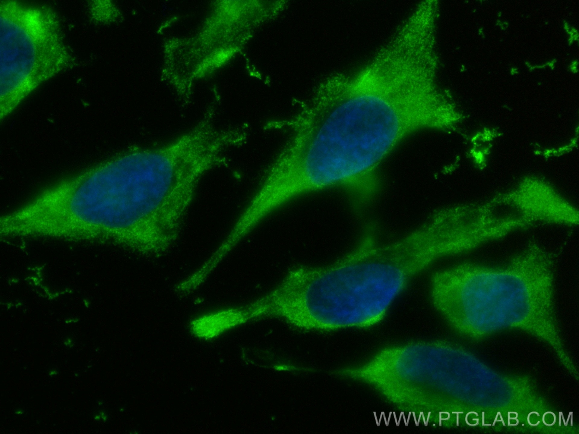 Immunofluorescence (IF) / fluorescent staining of HeLa cells using CoraLite® Plus 488-conjugated Caspase 2/p32/p18 Mo (CL488-66517)