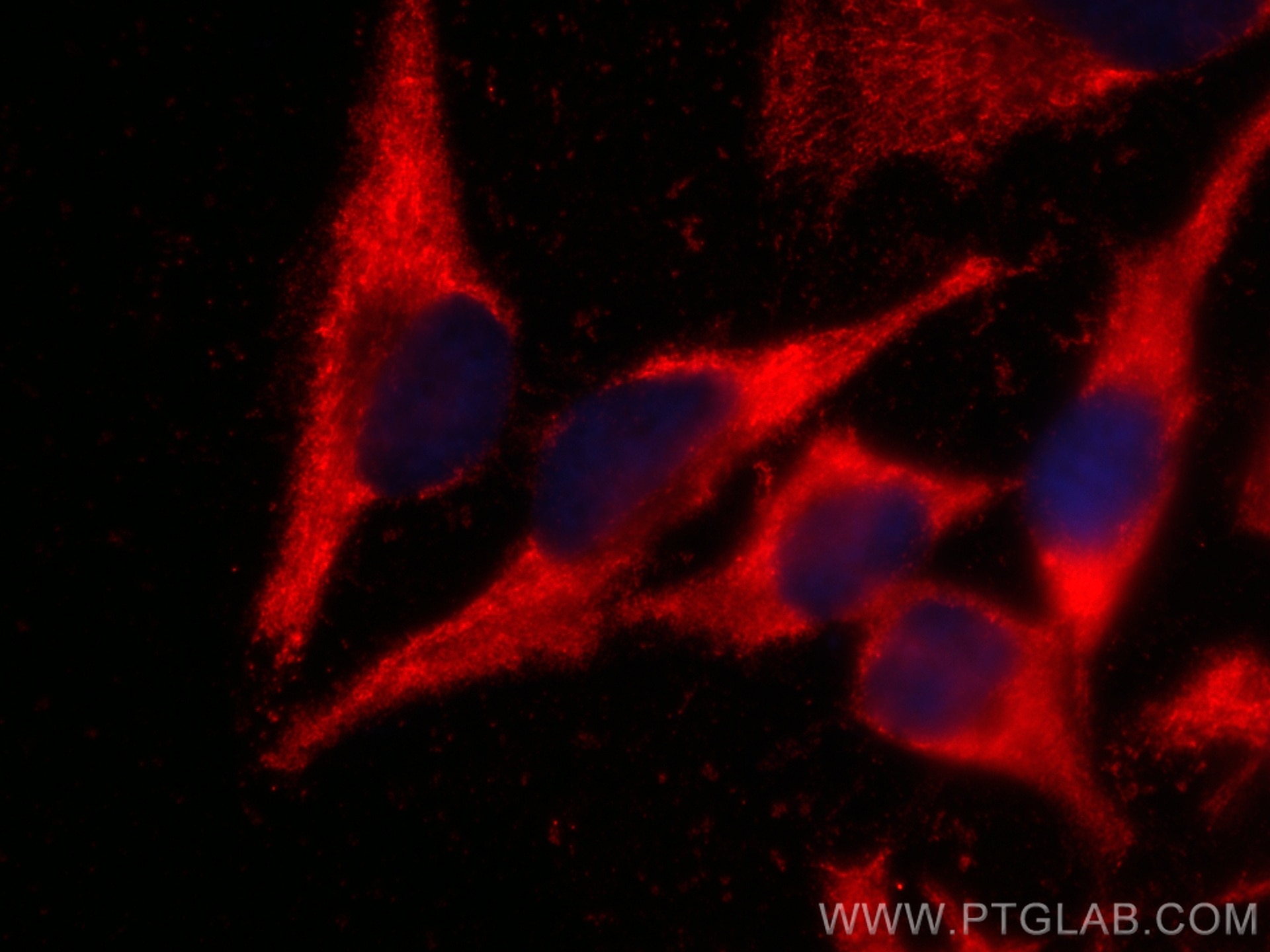 Immunofluorescence (IF) / fluorescent staining of HeLa cells using CoraLite®594-conjugated Caspase 2/p32/p18 Monoclon (CL594-66517)