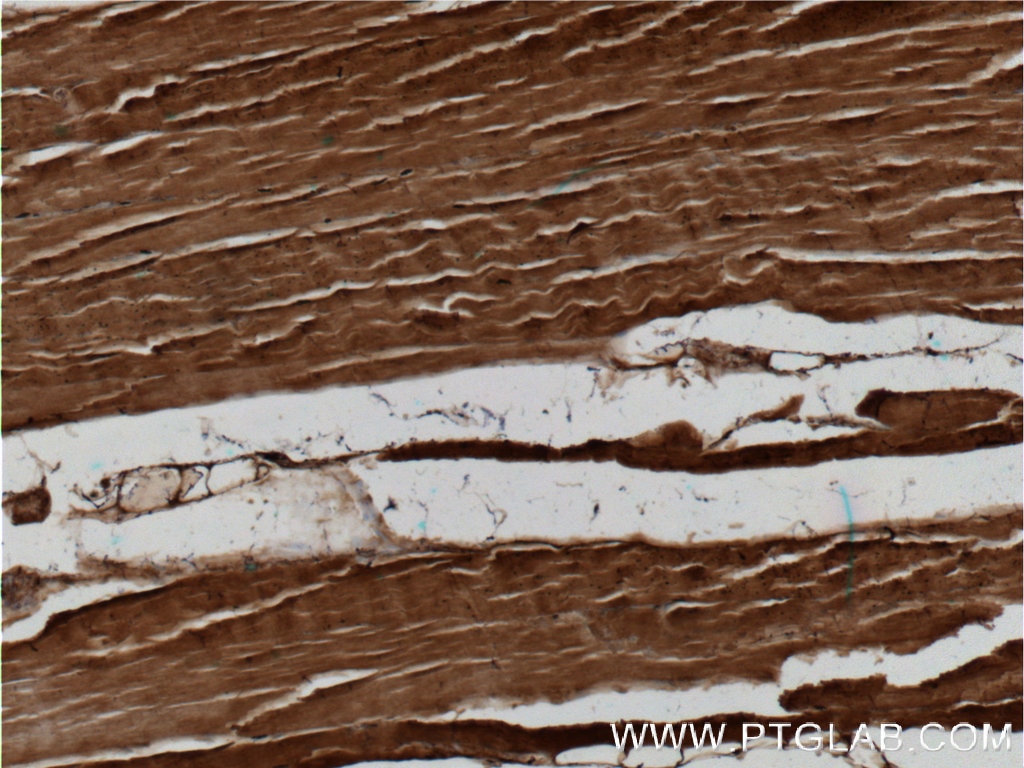 Immunohistochemistry (IHC) staining of human skeletal muscle tissue using cleaved-Caspase 3 Polyclonal antibody (25546-1-AP)