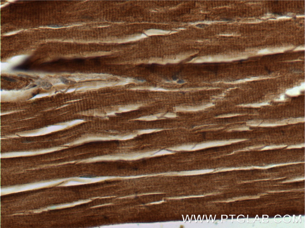 Immunohistochemistry (IHC) staining of human skeletal muscle tissue using cleaved-Caspase 3 Polyclonal antibody (25546-1-AP)