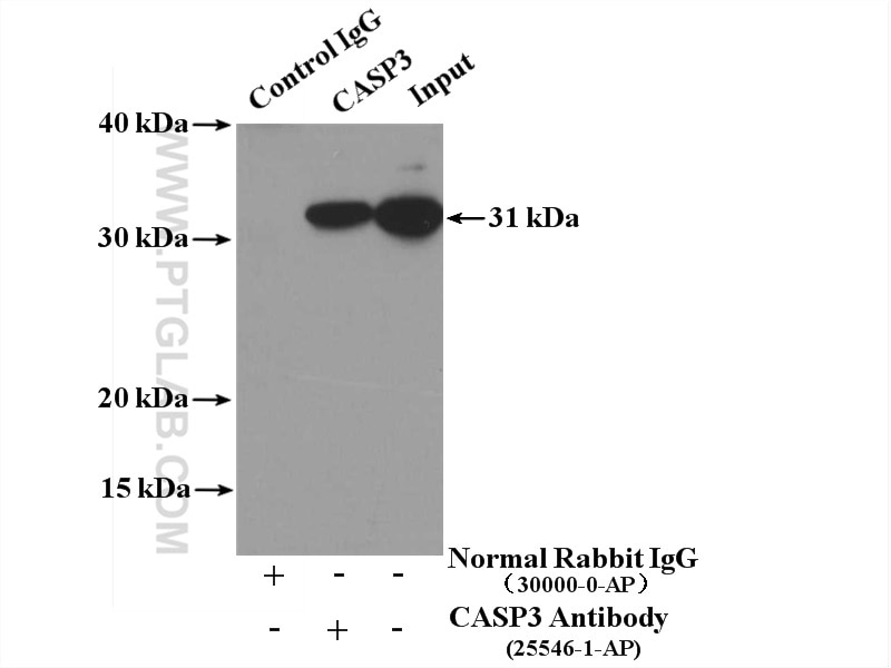 Immunoprecipitation (IP) experiment of Jurkat cells using cleaved-Caspase 3 Polyclonal antibody (25546-1-AP)