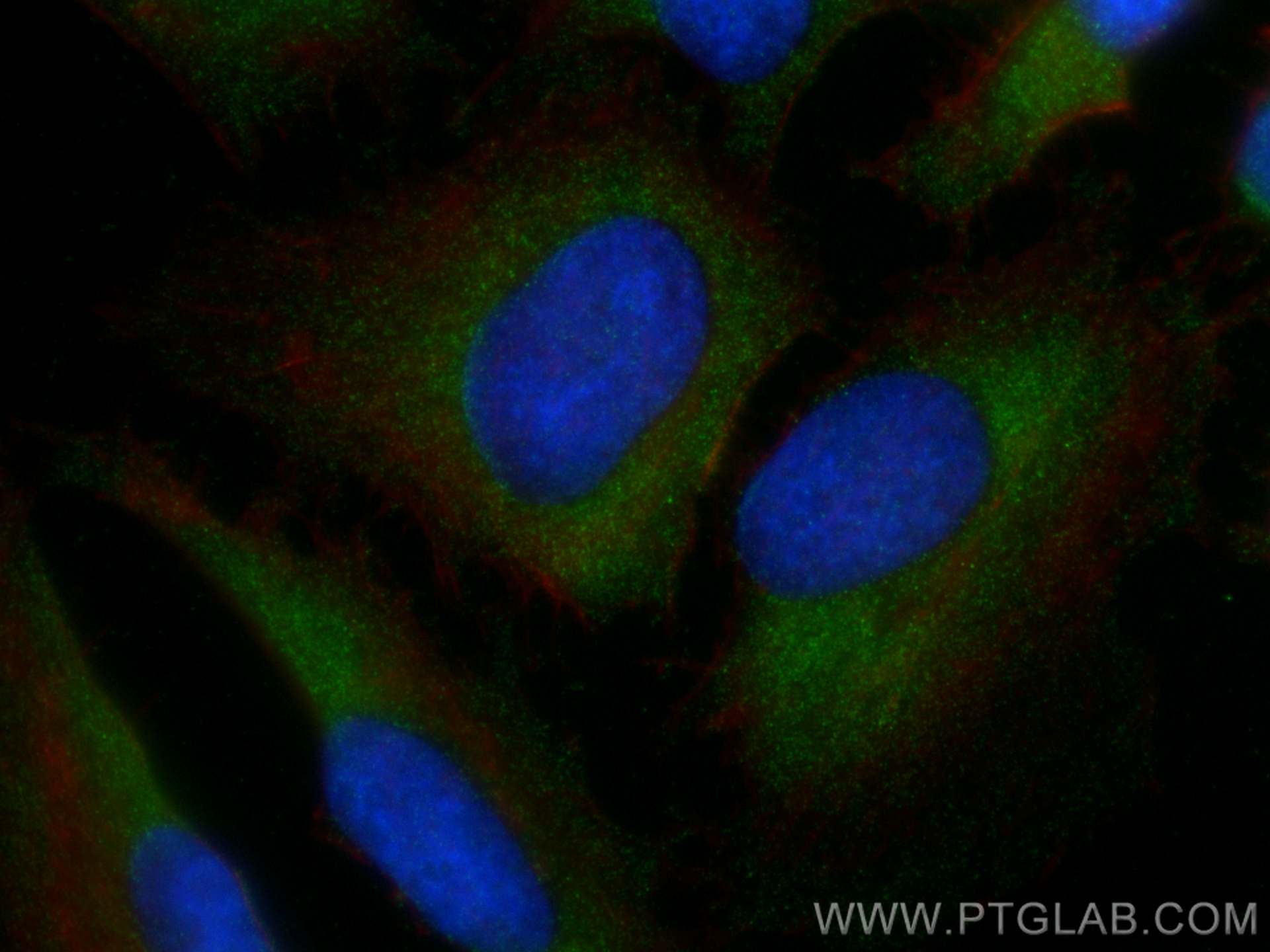 Immunofluorescence (IF) / fluorescent staining of HeLa cells using Caspase 3 Recombinant antibody (82202-1-RR)