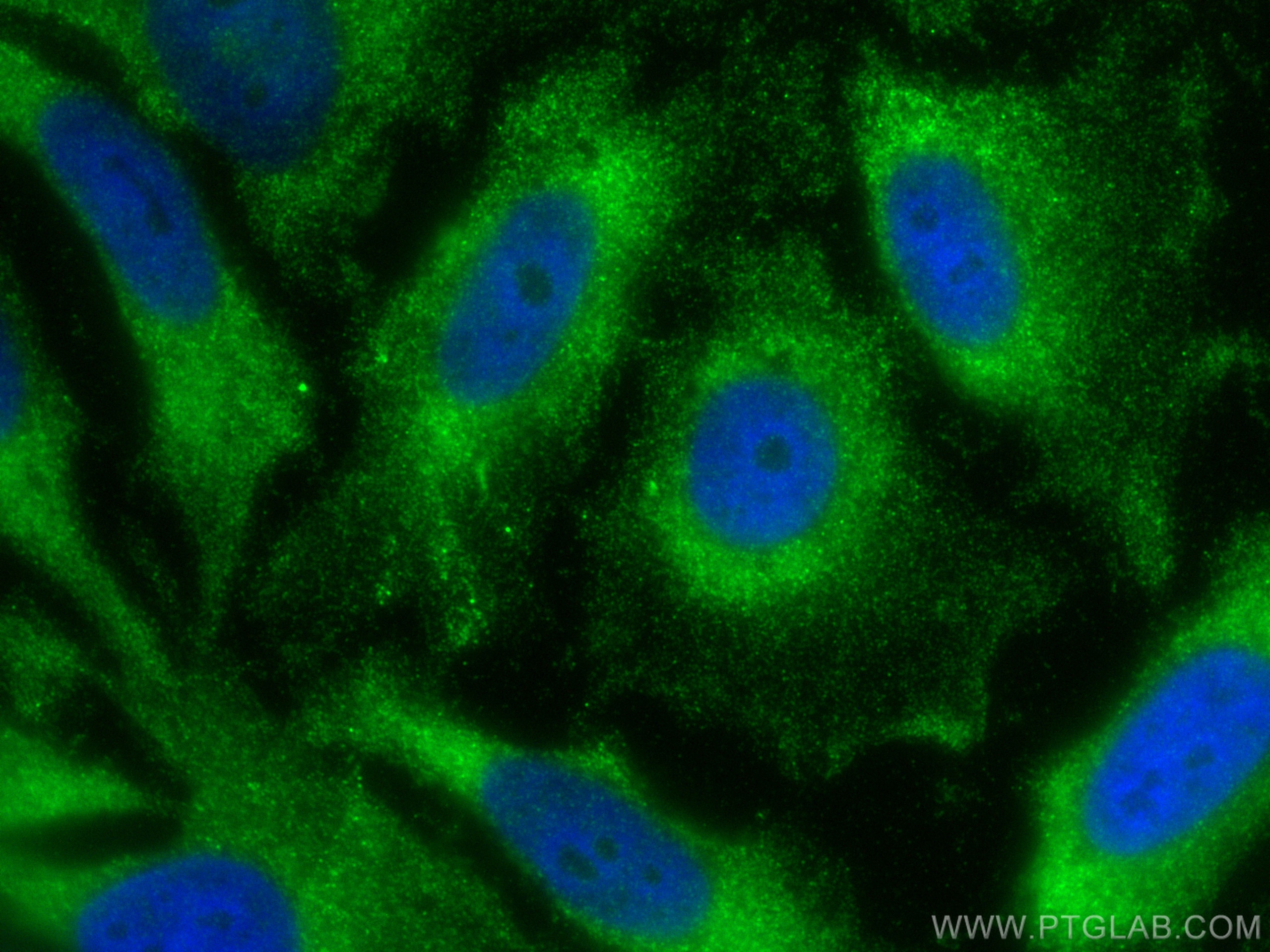 IF Staining of HeLa using 82202-1-RR