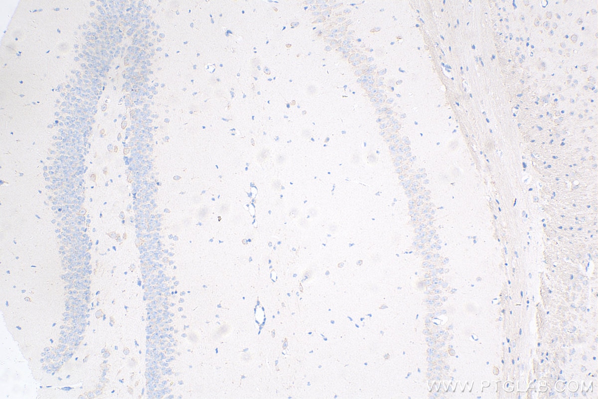 Immunohistochemistry (IHC) staining of mouse brain tissue using Caspase 3 Recombinant antibody (82202-1-RR)