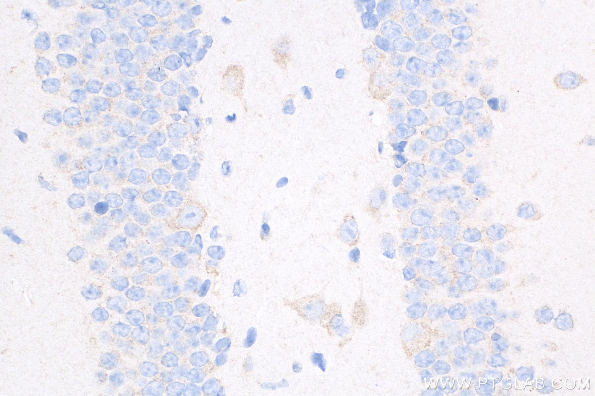 Immunohistochemistry (IHC) staining of mouse brain tissue using Caspase 3 Recombinant antibody (82202-1-RR)