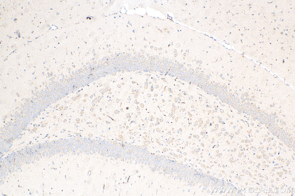 Immunohistochemistry (IHC) staining of mouse brain tissue using Caspase 3/P17/P19 Recombinant antibody (82202-1-RR)