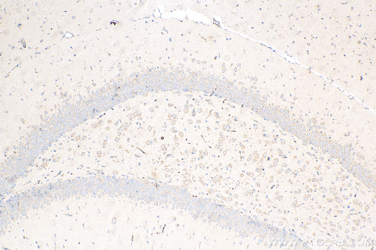 Immunohistochemistry (IHC) staining of mouse brain tissue using Caspase 3 Recombinant antibody (82202-1-RR)