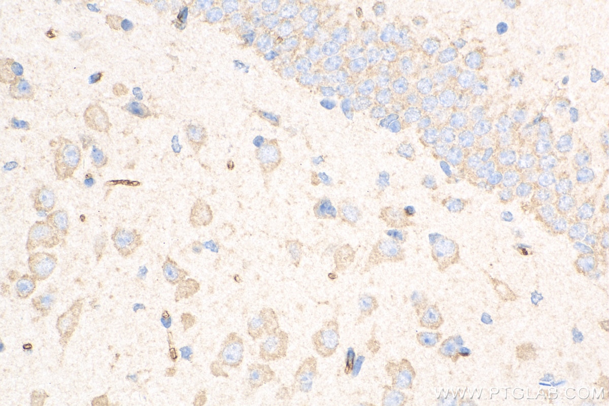 Immunohistochemistry (IHC) staining of mouse brain tissue using Caspase 3 Recombinant antibody (82202-1-RR)