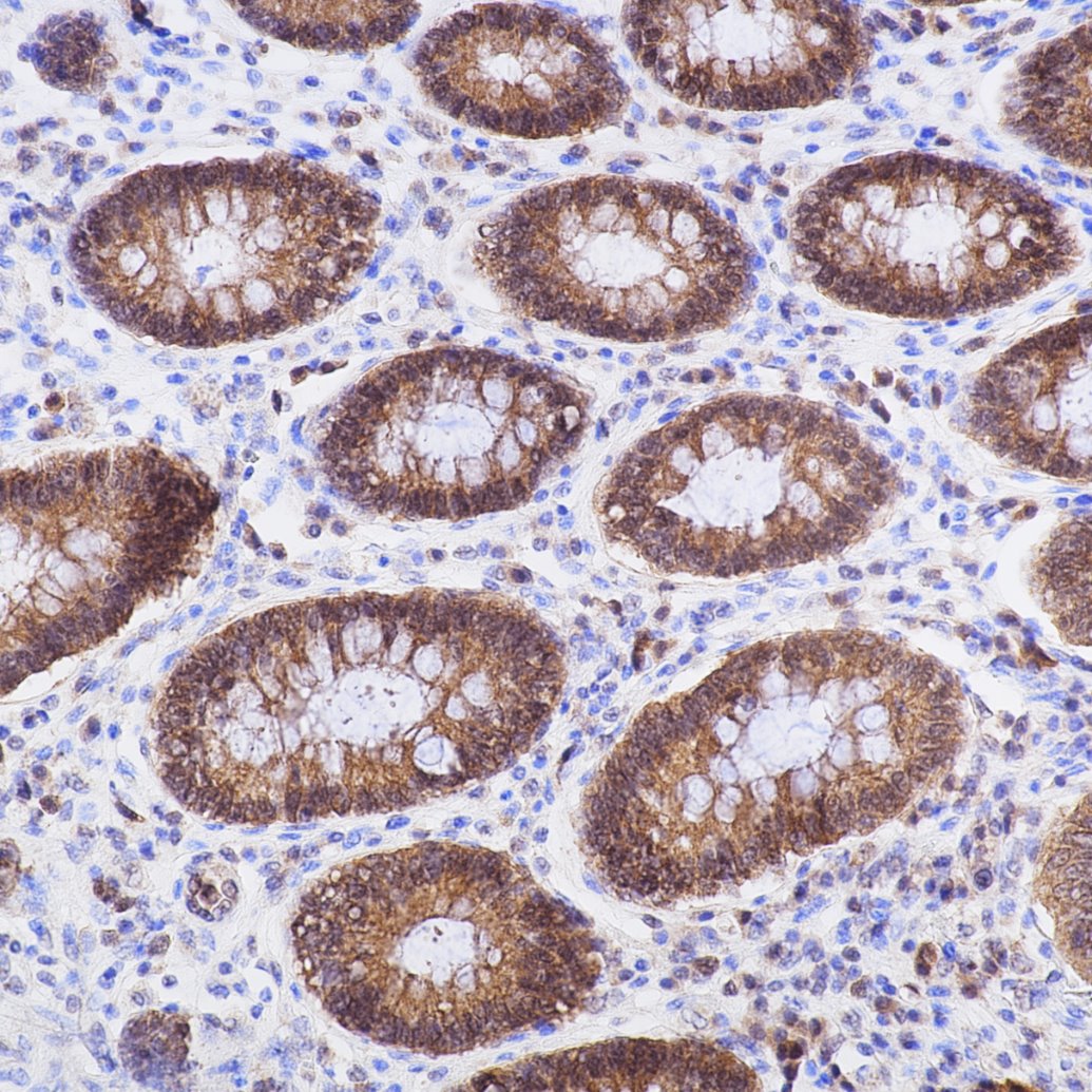 Immunohistochemistry (IHC) staining of human colon tissue using Caspase 3/P17/P19 Recombinant monoclonal antibody (82202-1-RR)