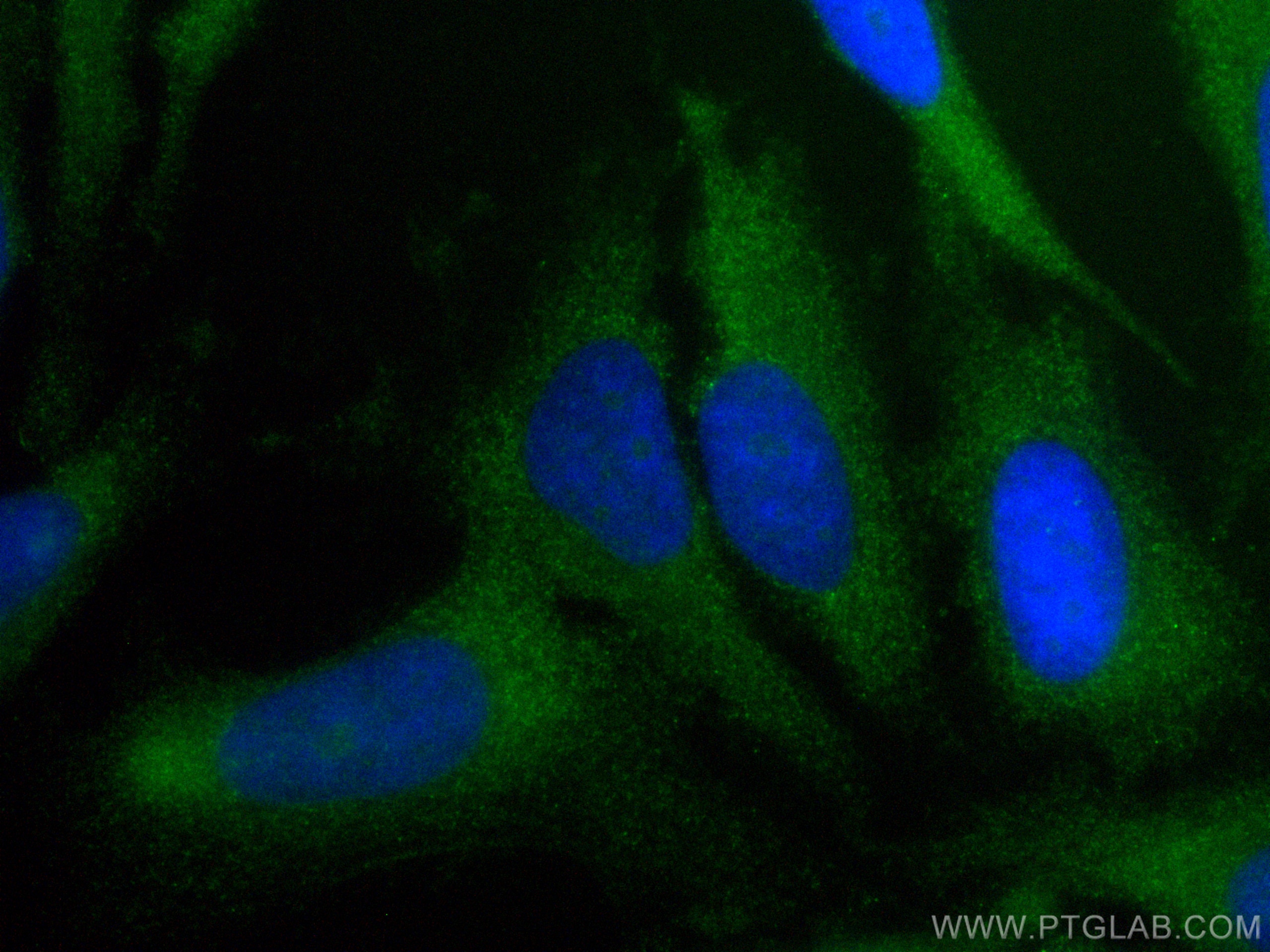 Immunofluorescence (IF) / fluorescent staining of HeLa cells using CoraLite® Plus 488-conjugated Caspase 3 Recombinan (CL488-82202)