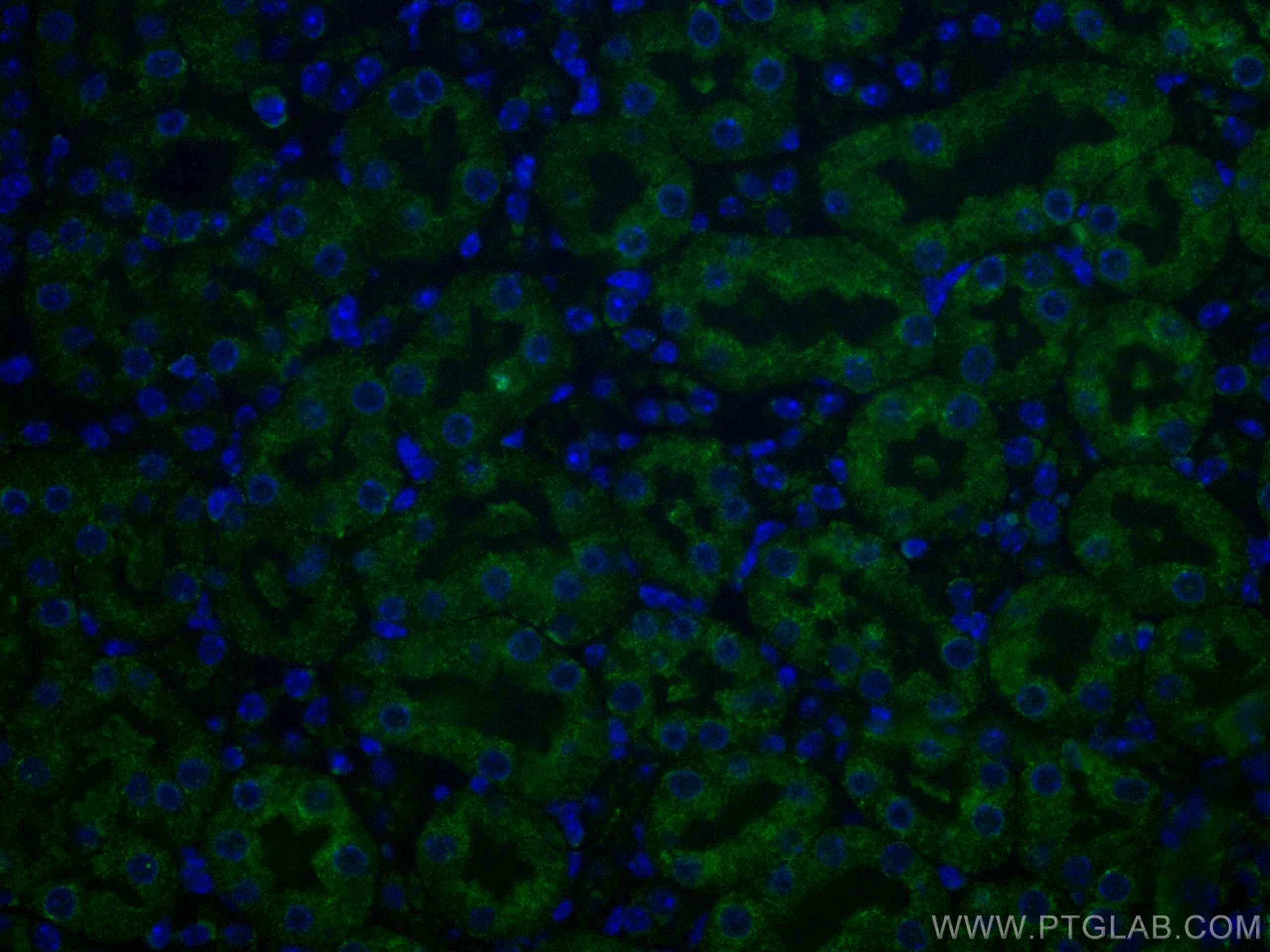 Immunofluorescence (IF) / fluorescent staining of human kidney tissue using CoraLite® Plus 488-conjugated Caspase 3/p17/p19 Mo (CL488-66470)
