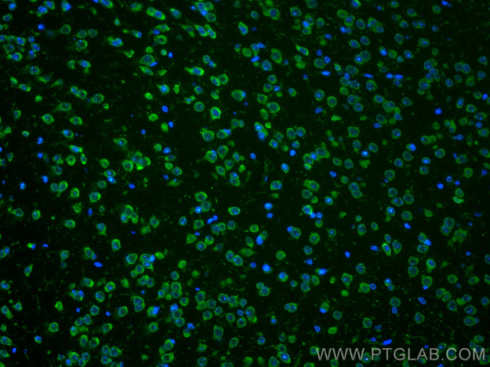 Immunofluorescence (IF) / fluorescent staining of mouse brain tissue using CoraLite® Plus 488-conjugated Caspase 3/p17/p19 Mo (CL488-66470)