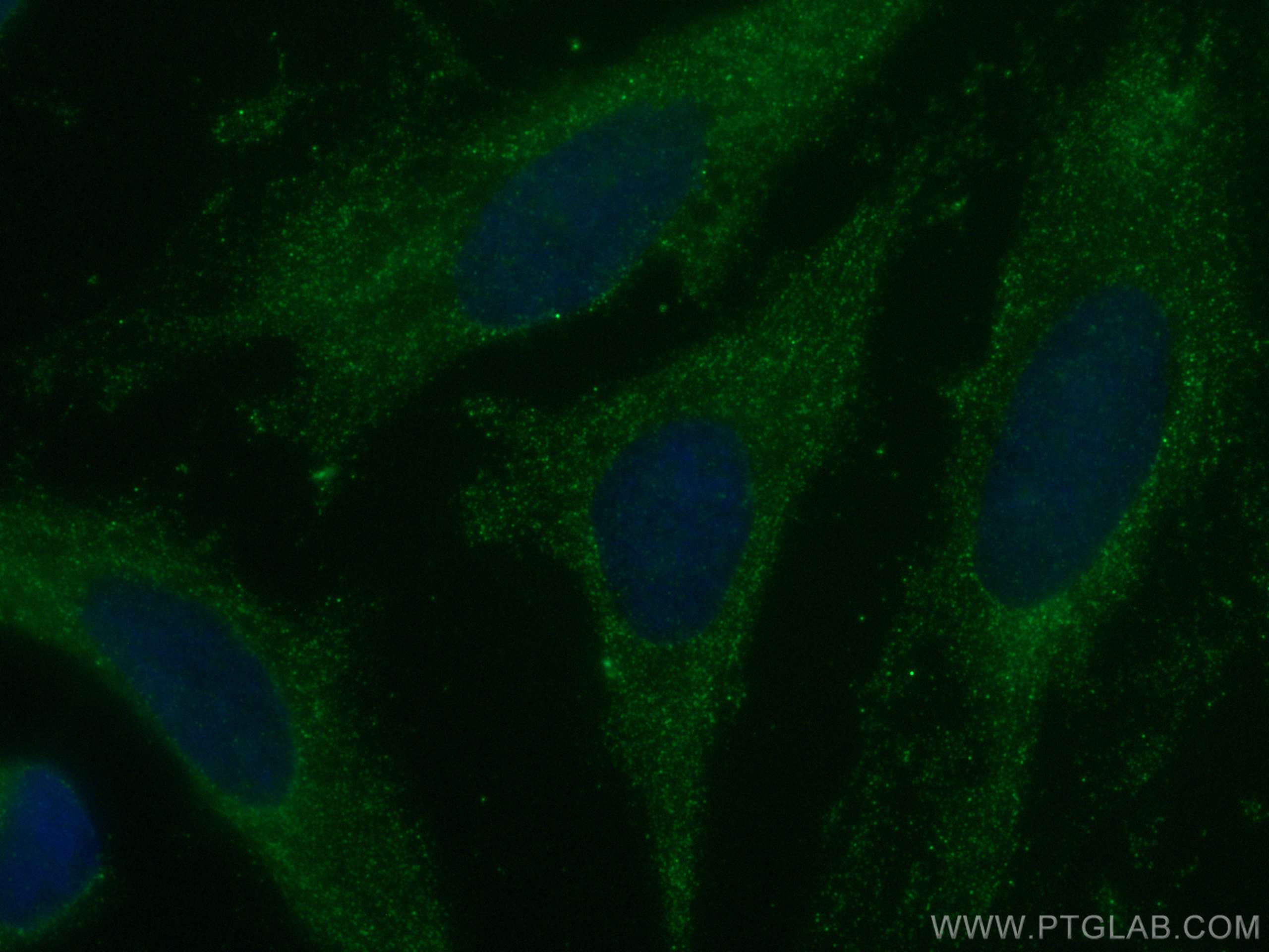 Immunofluorescence (IF) / fluorescent staining of HeLa cells using CoraLite® Plus 488-conjugated Caspase 4 Monoclonal (CL488-67398)
