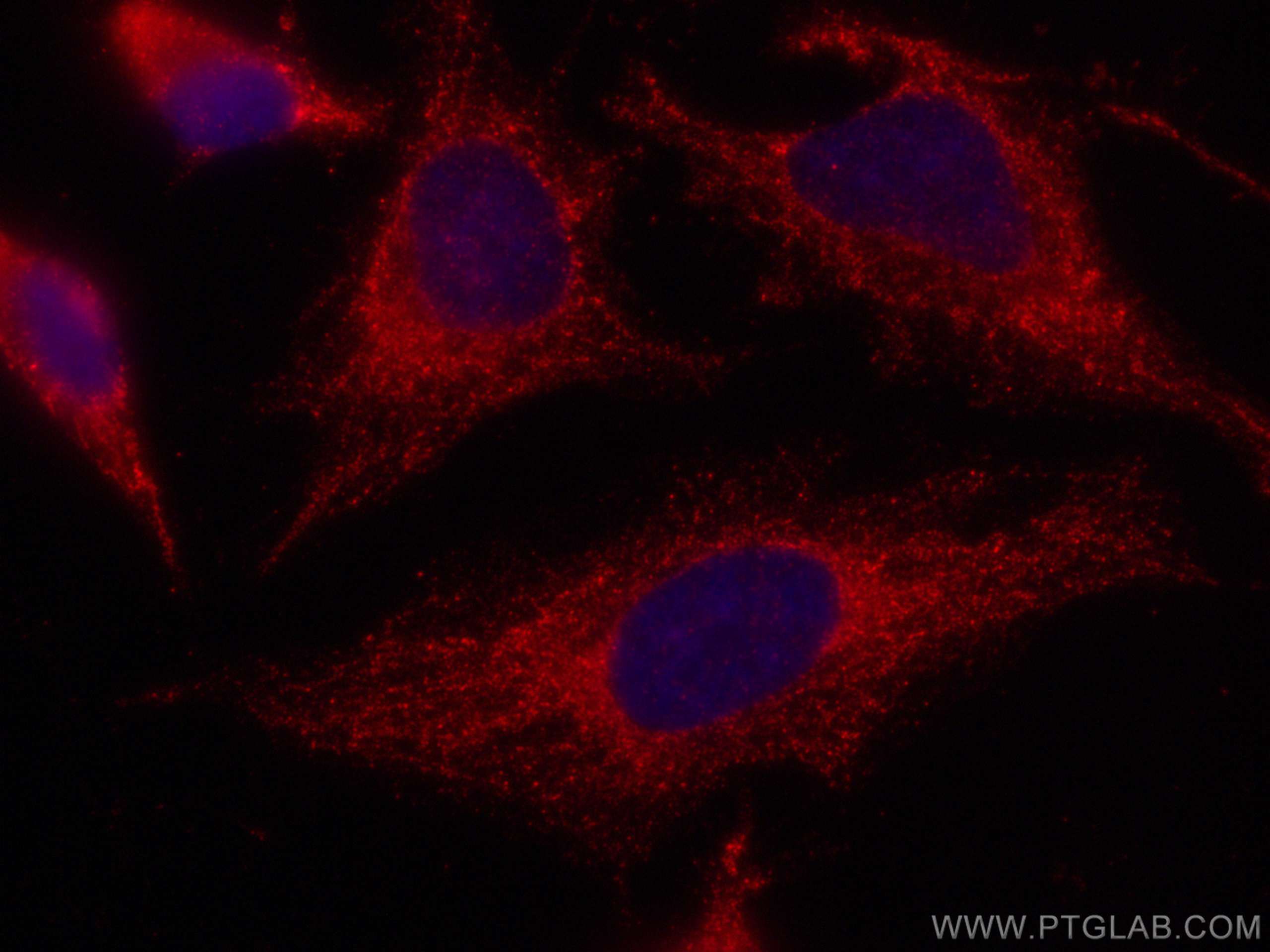 Immunofluorescence (IF) / fluorescent staining of HeLa cells using CoraLite®594-conjugated Caspase 4 Monoclonal antib (CL594-67398)
