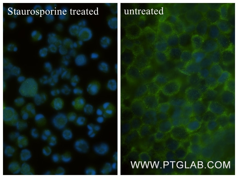 Immunofluorescence (IF) / fluorescent staining of Jurkat cells using Caspase 6 Recombinant antibody (85201-2-RR)