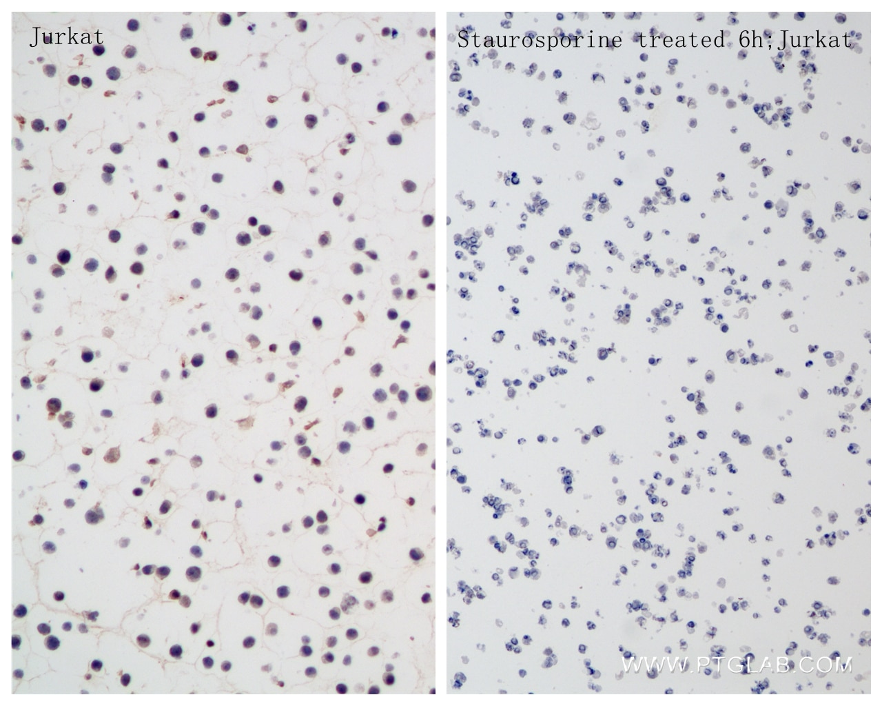 Immunohistochemistry (IHC) staining of Jurkat cells using Caspase 6 Recombinant antibody (85201-2-RR)