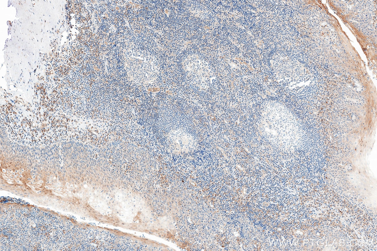 Immunohistochemistry (IHC) staining of human tonsil tissue using Caspase 6 Recombinant monoclonal antibody (85201-2-RR)