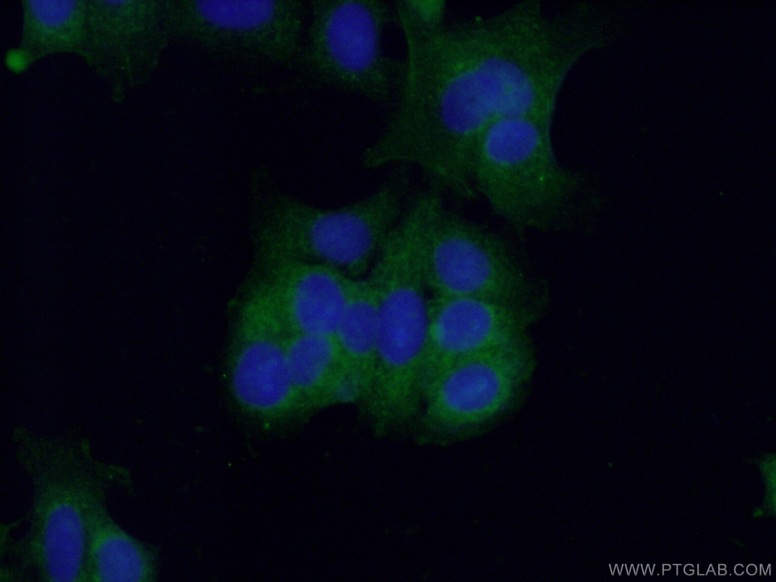 Immunofluorescence (IF) / fluorescent staining of MCF-7 cells using Caspase 7/p20 Polyclonal antibody (27155-1-AP)