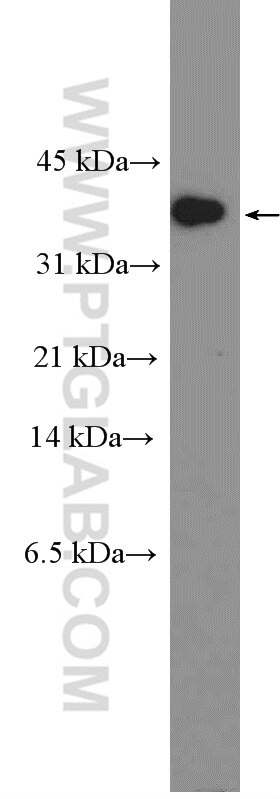 Western Blot (WB) analysis of LNCaP cells using Caspase 7/p20 Polyclonal antibody (27155-1-AP)