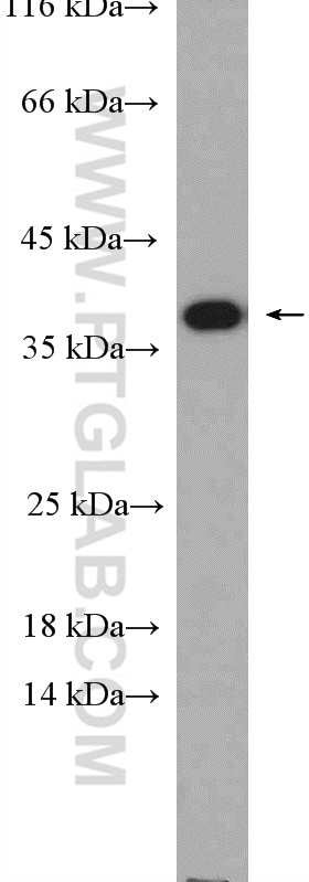 Western Blot (WB) analysis of LNCaP cells using Caspase 7/p20 Polyclonal antibody (27155-1-AP)