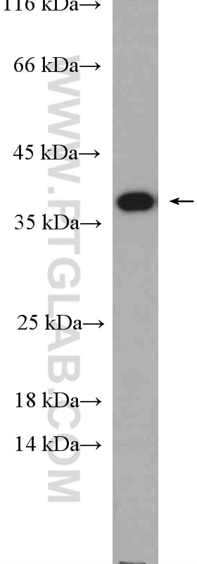 WB analysis of LNCaP using 27155-1-AP