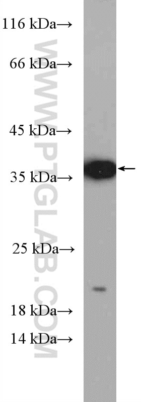 Western Blot (WB) analysis of MCF-7 cells using Caspase 7/p20 Polyclonal antibody (27155-1-AP)