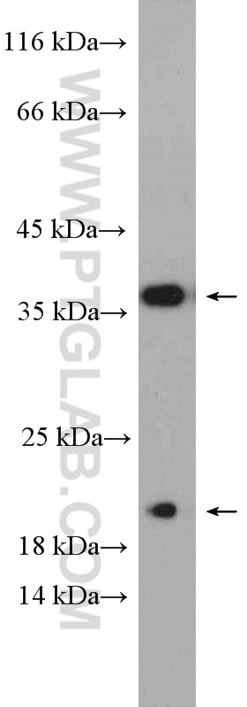 Western Blot (WB) analysis of PC-3 cells using Caspase 7/p20 Polyclonal antibody (27155-1-AP)