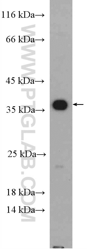 Western Blot (WB) analysis of mouse liver tissue using Caspase 7/p20 Polyclonal antibody (27155-1-AP)