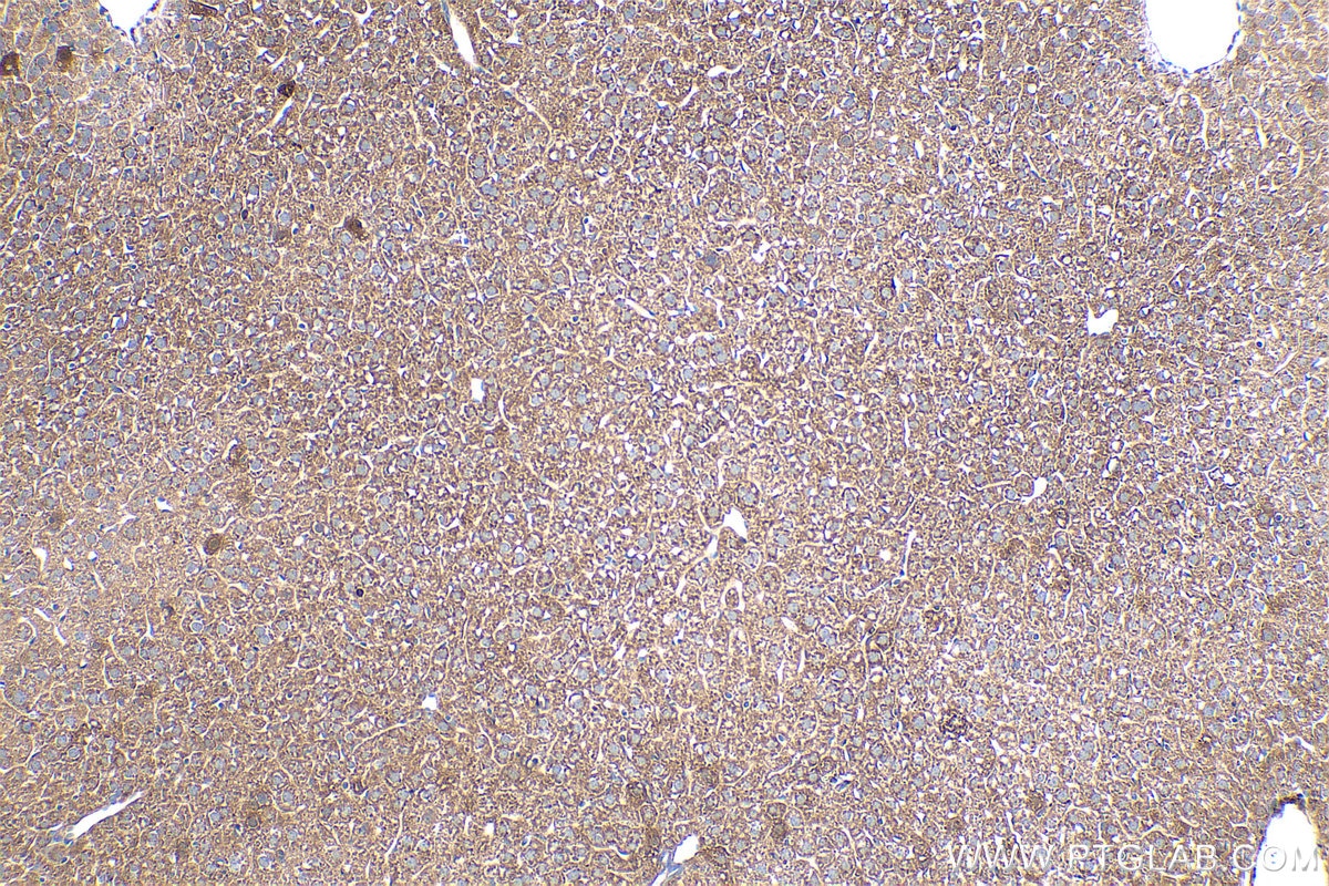 Immunohistochemistry (IHC) staining of mouse liver tissue using Caspase 7 Monoclonal antibody (67956-1-Ig)