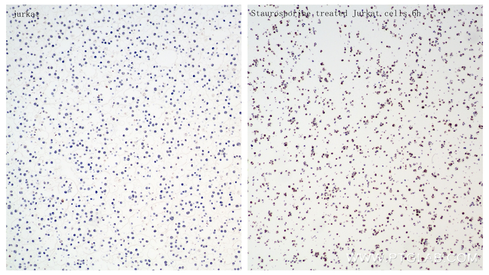 Immunohistochemistry (IHC) staining of Jurkat cells using Cleaved Caspase 8/P18 Recombinant antibody (85171-3-RR)
