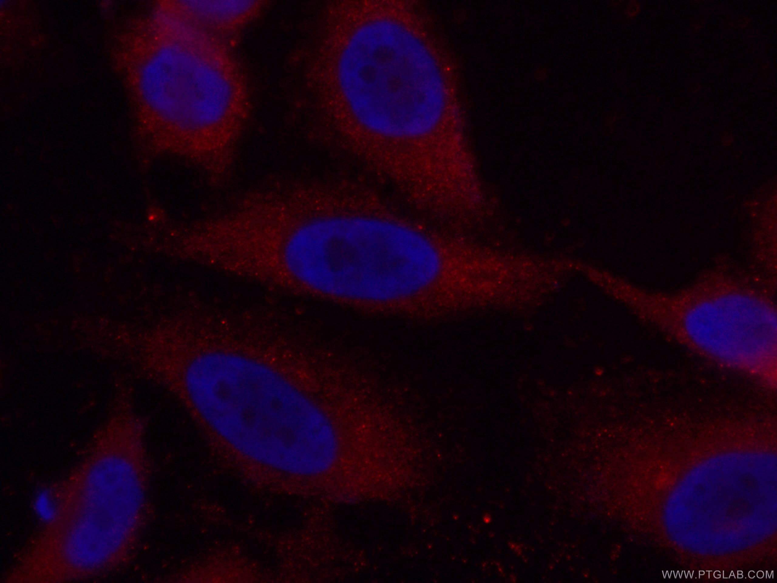 Immunofluorescence (IF) / fluorescent staining of HeLa cells using CoraLite®594-conjugated Caspase 8/p43/p18 Monoclon (CL594-66093)