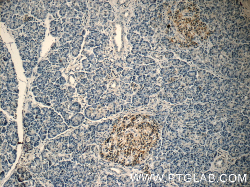Immunohistochemistry (IHC) staining of human pancreas tissue using Caspase 9/p35/p10 Monoclonal antibody (66169-1-Ig)