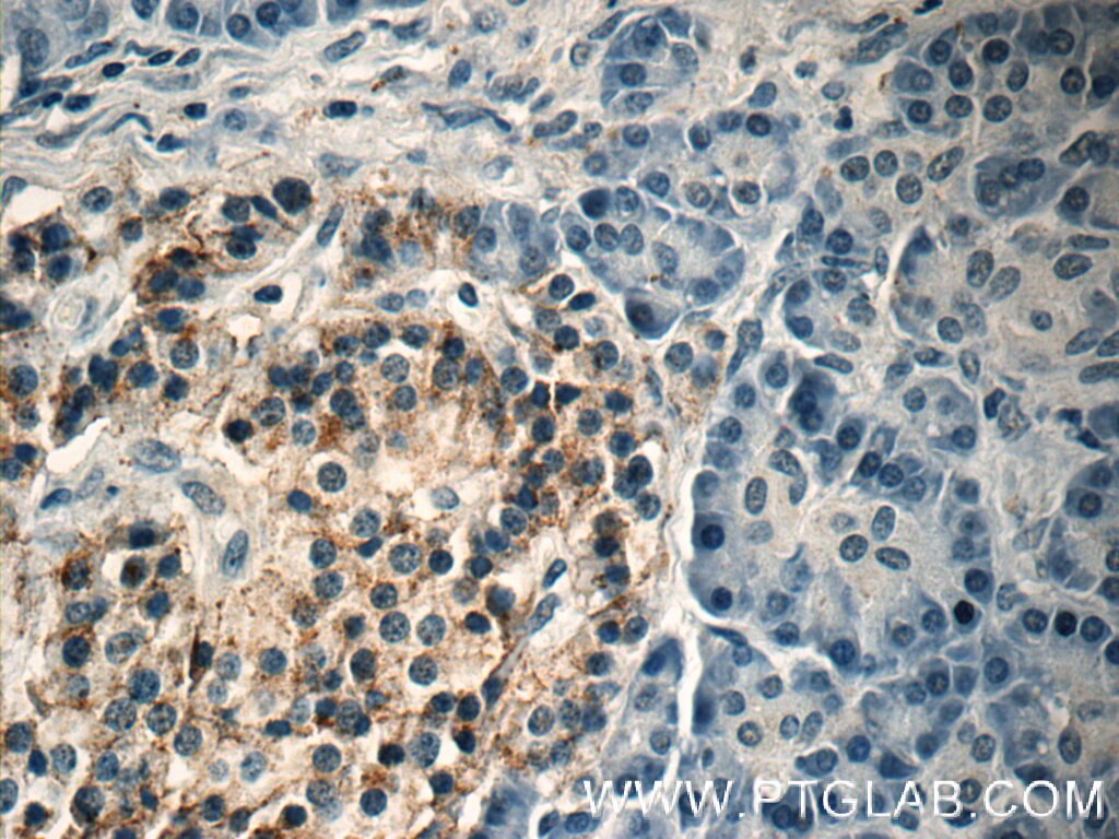 IHC staining of human pancreas using 66169-1-Ig