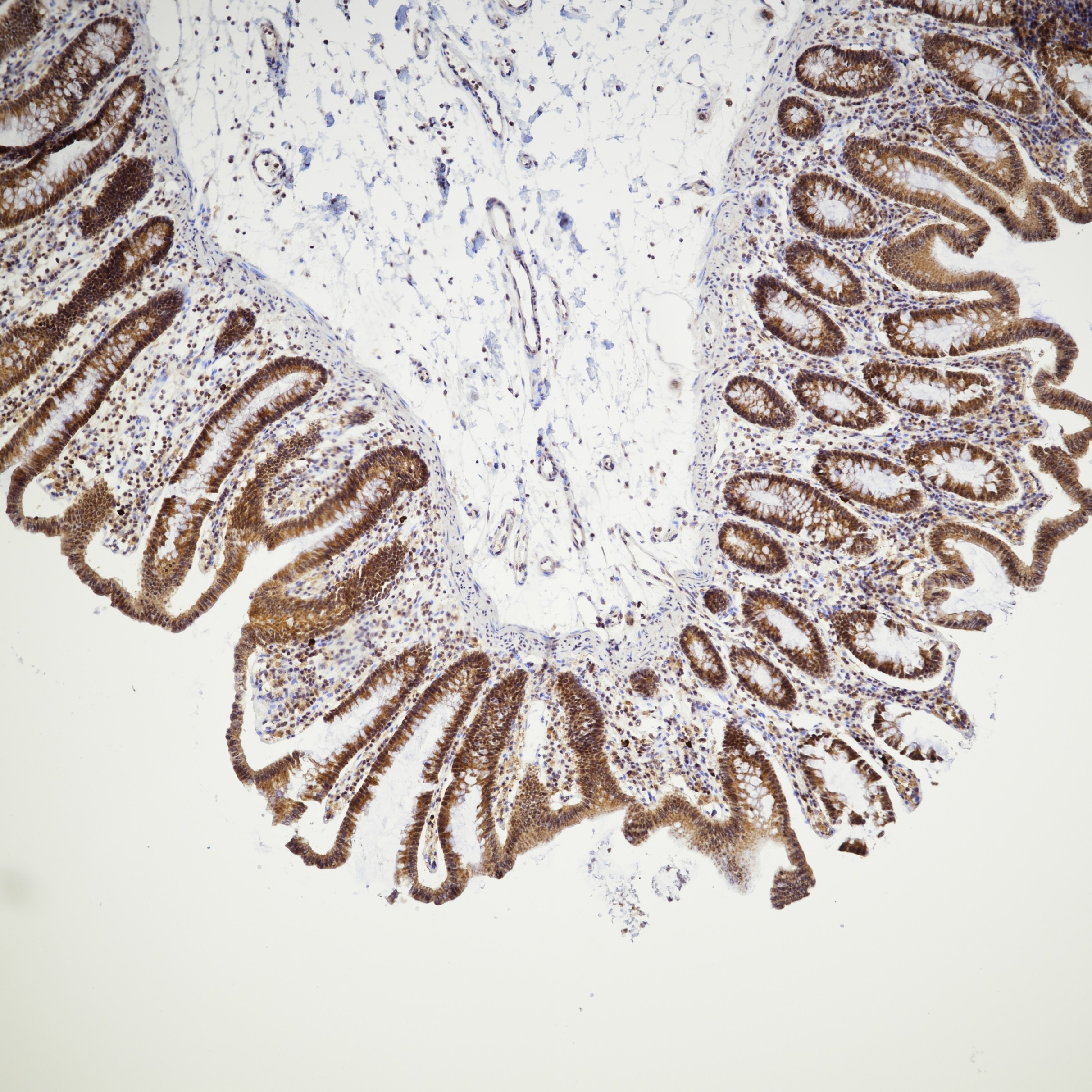 IHC staining of human colon using 66169-1-Ig Immunohistochemistry (IHC) staining of human colon tissue using Caspase 9/P35 Monoclonal antibody (66169-1-Ig)