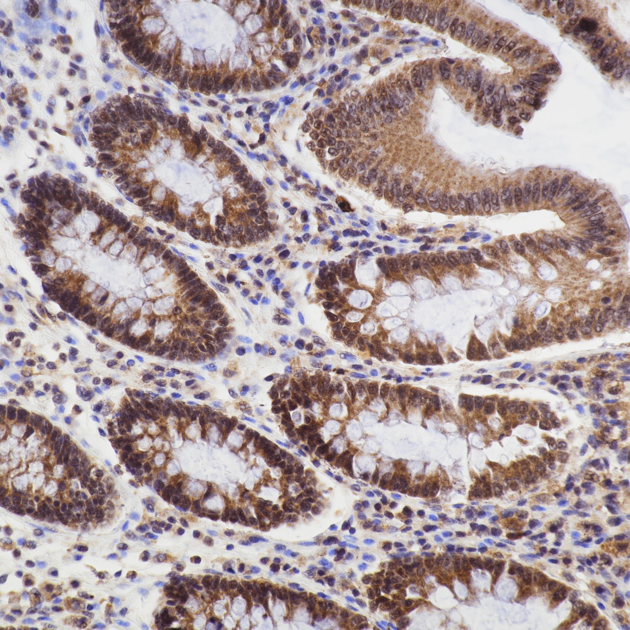 IHC staining of human colon using 66169-1-Ig Immunohistochemistry (IHC) staining of human colon tissue using Caspase 9/P35 Monoclonal antibody (66169-1-Ig)