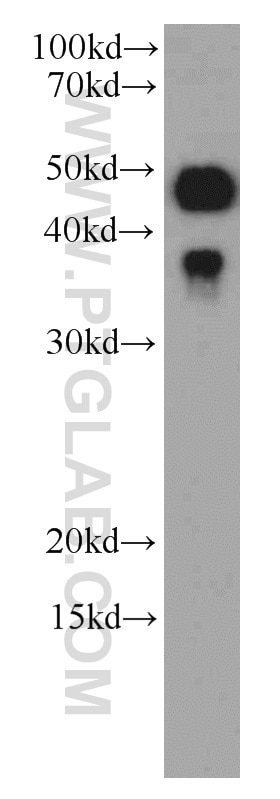 Western Blot (WB) analysis of HeLa cells using Caspase 9/p35/p10 Monoclonal antibody (66169-1-Ig)